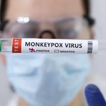 Cómo reconocer las lesiones de la viruela del mono