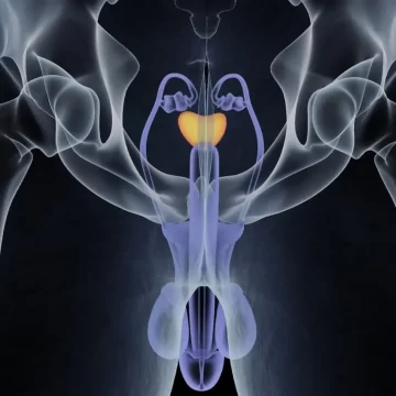 Cáncer de próstata más benigno en los hombres que en mujeres