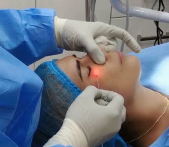 Clínica del Dr. Lee impulsa el rejuvenecimiento facial con la innovadora técnica de Láser Lifting de rostro y cuello